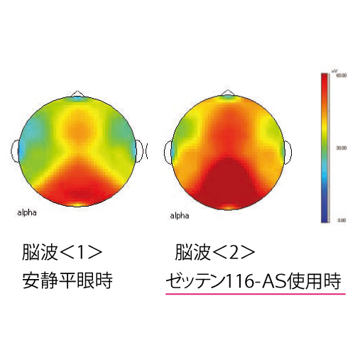 ゼッテン